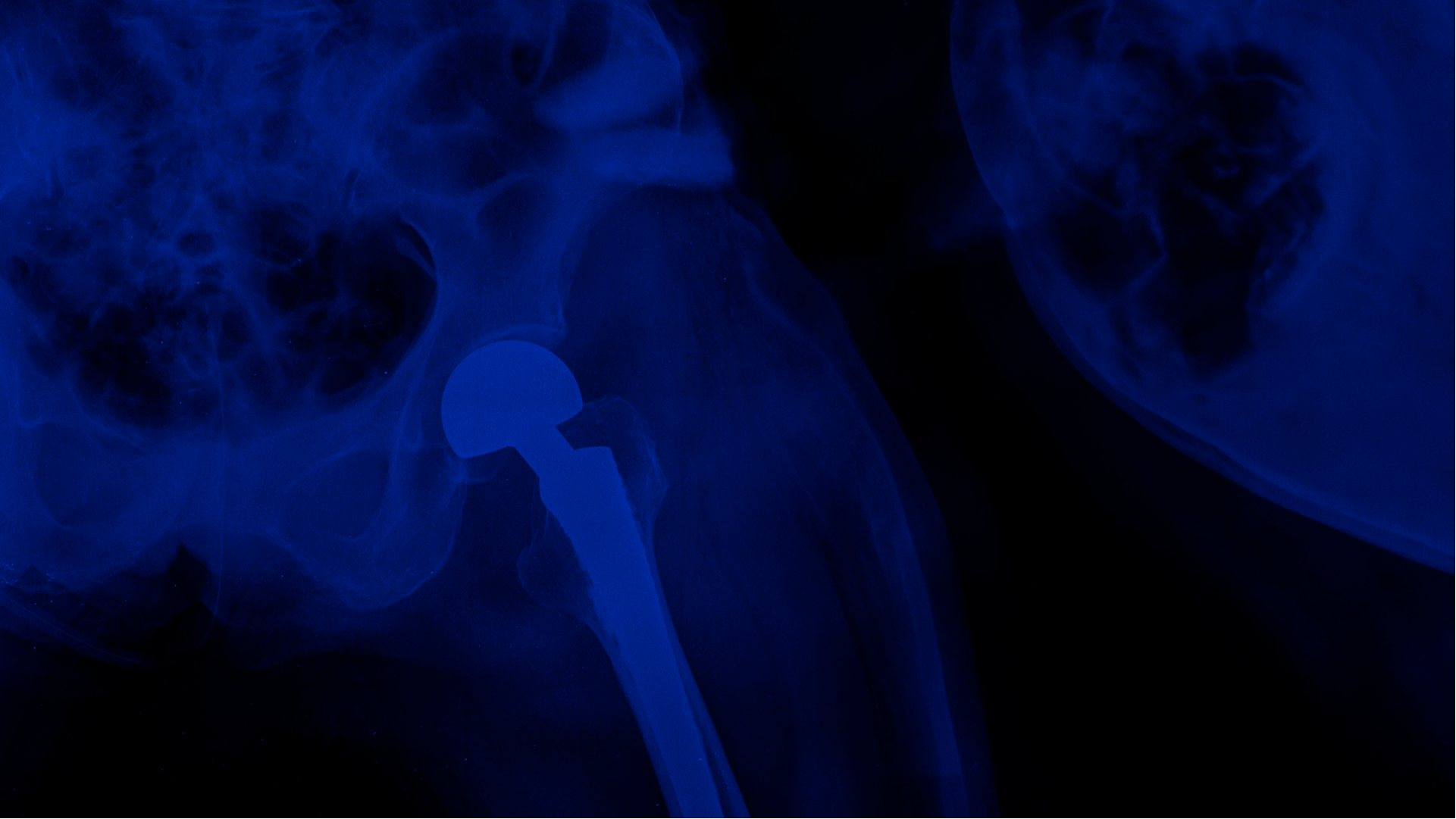 OsteoTech Implantes Banner
