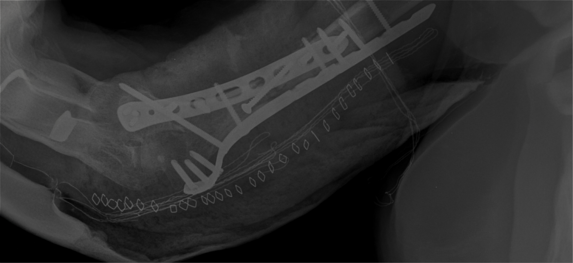 OsteoTech Implantes Banner